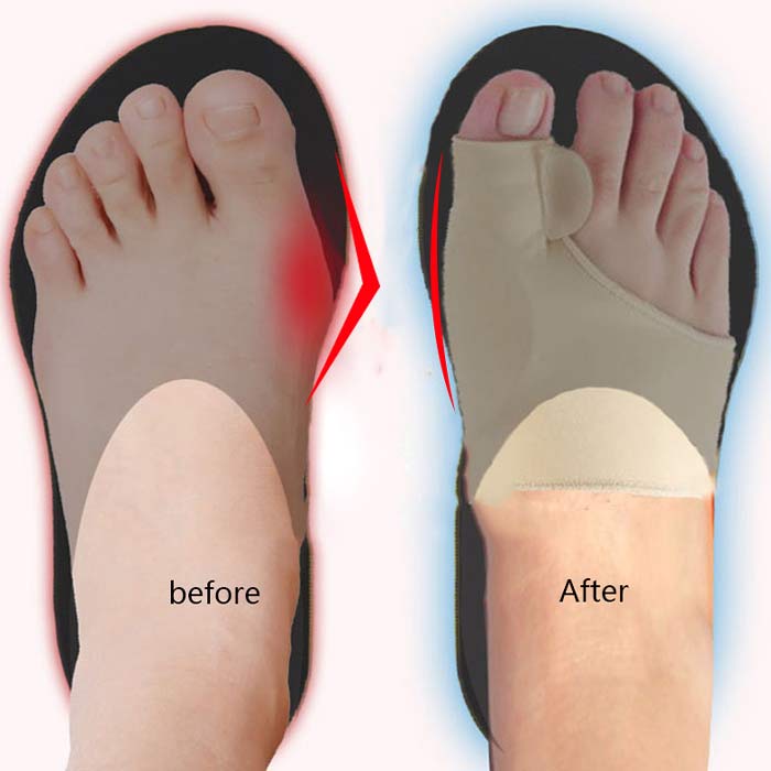 CorrectiveSocks, korekcijske čarape - Image 3