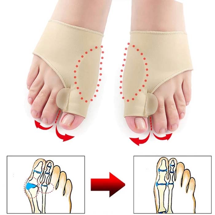 CorrectiveSocks, korekcijske čarape - Image 5