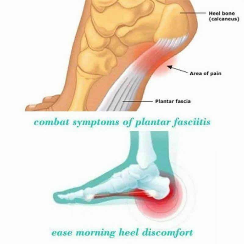 TherapySocks, terapeutske čarape s magnetima - Image 3